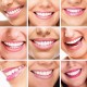 Система відбілювання зубів на батарейках, Dental White