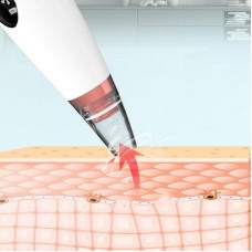 Вакуумний апарат для чищення пір Pore Cleaner MA-59 + 6 насадок